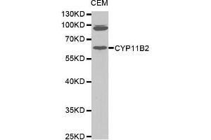 Western Blotting (WB) image for anti-Cytochrome P450, Family 11, Subfamily B, Polypeptide 2 (CYP11B2) (AA 234-503) antibody (ABIN1679468) (CYP11B2 Antikörper  (AA 234-503))