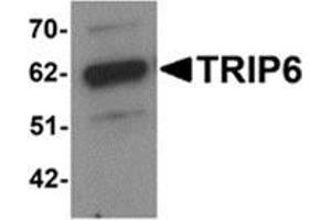 Western blot analysis of TRIP6 in EL4 cell lysate with TRIP6 antibody at 1 μg/ml. (TRIP6 Antikörper  (Center))