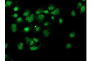 Anti-PDSS2 mouse monoclonal antibody (ABIN2455333) immunofluorescent staining of COS7 cells transiently transfected by pCMV6-ENTRY PDSS2 (RC207892). (PDSS2 Antikörper)