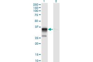 Western Blot analysis of ACOT8 expression in transfected 293T cell line by ACOT8 monoclonal antibody (M03), clone 3F1. (ACOT8 Antikörper  (AA 108-215))