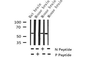 Western Blotting (WB) image for anti-Tyrosine Hydroxylase (TH) (pSer40) antibody (ABIN6255304)