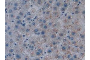 Detection of HO1 in Human Liver Tissue using Polyclonal Antibody to Heme Oxygenase 1 (HO1) (HMOX1 Antikörper  (AA 61-172))