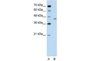 LRP2BP antibody used at 1 ug/ml to detect target protein. (LRP2BP Antikörper  (Middle Region))