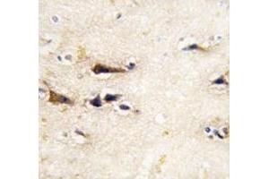 IHC analysis of FFPE human brain tissue stained with BACE1 antibody (BACE1 Antikörper  (AA 38-70))