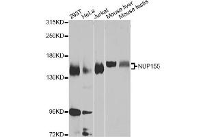 Western blot analysis of extracts of various cell lines, using NUP155 Antibody (ABIN5975637) at 1/1000 dilution. (NUP155 Antikörper)