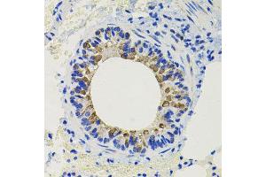 Immunohistochemistry of paraffin-embedded mouse lung using CALB2 antibody at dilution of 1:100 (x40 lens). (Calretinin Antikörper)