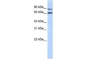 GPR75 antibody used at 1 ug/ml to detect target protein. (GPR75 Antikörper  (Middle Region))