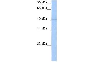 RBM4 antibody used at 0. (RBM4 Antikörper  (C-Term))