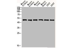 Western blot analysis of mouse-kidney lysate, antibody was diluted at 2000. (FCGR1A Antikörper  (AA 230-280))