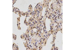 Immunohistochemistry (IHC) image for anti-Neuropilin 2 (NRP2) (AA 150-420) antibody (ABIN1681113) (NRP2 Antikörper  (AA 150-420))