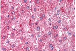 Human Liver (formalin-fixed, paraffin-embedded) stained with ATM antibody ABIN213900 at 1-2 ug/ml followed by biotinylated goat anti-rabbit IgG secondary antibody ABIN481713, alkaline phosphatase-streptavidin and chromogen. (ATM Antikörper  (C-Term))