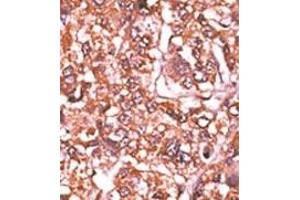 Image no. 2 for anti-Retinoblastoma 1 (RB1) (pSer612) antibody (ABIN358212) (Retinoblastoma 1 Antikörper  (pSer612))