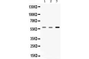 Western blot analysis of Catalase expression in rat skeletal muscle extract ( Lane 1), mouse skeletal muscle extract ( Lane 2) and A549 whole cell lysates ( Lane 3).