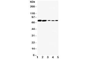 Western blot testing of SGLT1 antibody and Lane 1:  rat kidney;  2: (r) heart;  3: human HeLa;  4: (h) SW620;  5: (h) COLO320 cell lysate. (SLC5A1 Antikörper  (C-Term))