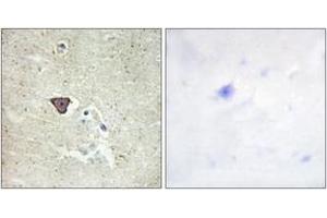 Immunohistochemistry (IHC) image for anti-Cadherin 9 (CDH9) (AA 201-250) antibody (ABIN2889889) (Cadherin 9 Antikörper  (AA 201-250))