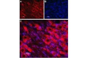 anti-Cholinergic Receptor, Nicotinic, beta 4 (Neuronal) (CHRNB4) (AA 95-108), (Extracellular) antibody (Atto 594)