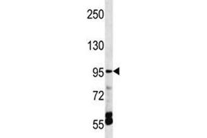 TRPV5 antibody western blot analysis in HepG2 lysate. (TRPV5 Antikörper  (AA 634-663))