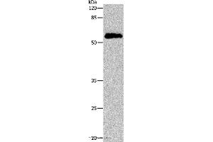 Western blot analysis of Human cervical cancer tissue, using CDC20 Polyclonal Antibody at dilution of 1:600 (CDC20 Antikörper)