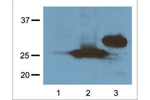 1:1000 (1μg/mL) Ab dilution probed against HEK293 cells transfected with RFP-tagged protein vector, untransfected control (1), transfected with Turbo-RFP (2), and transfected with DeRed (3) (RFP Antikörper  (N-Term))