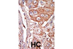 Immunohistochemistry (IHC) image for anti-Fibroblast Growth Factor 4 (FGF4) antibody (ABIN3003719) (FGF4 Antikörper)