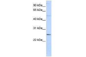 FTHL17 antibody used at 1 ug/ml to detect target protein. (FTHL17 Antikörper  (N-Term))