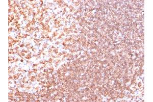 Formalin-fixed, paraffin-embedded human Tonsil stained with CD74 Ab (SPM523). (CD74 Antikörper)