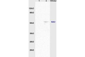 Lane 1: mouse brain lysates Lane 2: mouse heart lysates probed with Anti ACTRIC/Activin A Receptor Type IC Polyclonal Antibody, Unconjugated (ABIN714596) at 1:200 in 4 °C. (ACVR1C/ALK7 Antikörper  (AA 21-120))