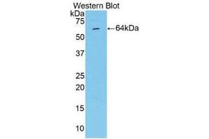 Western Blotting (WB) image for anti-Matrix Metalloproteinase 2 (MMP2) (AA 110-660) antibody (ABIN1859851)