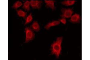 ABIN6275824 staining Hela by IF/ICC. (CYP20A1 Antikörper  (Internal Region))