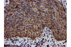 Image no. 3 for anti-Protein Disulfide Isomerase Family A, Member 4 (PDIA4) antibody (ABIN1500110)