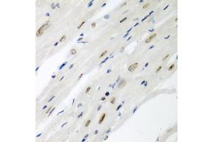 Immunohistochemistry of paraffin-embedded mouse heart using CDC27 antibody (ABIN3015756, ABIN3015757, ABIN1679113 and ABIN6219104) at dilution of 1:200 (40x lens). (CDC27 Antikörper  (AA 551-830))