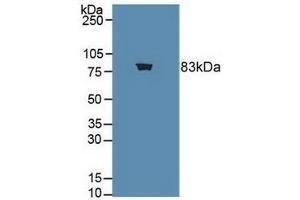 Choline Acetyltransferase Antikörper  (AA 517-732)