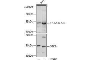 Western blot analysis of extracts of 293 cells, using Phospho-GSK3α-S21 antibody (ABIN6135231, ABIN6136096, ABIN6136097 and ABIN6225606) at 1:1000 dilution or GSK3α antibody (ABIN1680131, ABIN3015275, ABIN3015276 and ABIN6213918). (GSK3 alpha Antikörper  (pSer21))