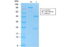 SDS-PAGE Analysis of Purified TP53 Rabbit Recombinant Monoclonal Antibody ABIN6383819. (Rekombinanter p53 Antikörper  (AA 16-25))