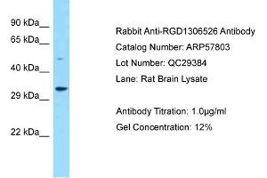 Western Blotting (WB) image for anti-Family with Sequence Similarity 212, Member B (FAM212B) (Middle Region) antibody (ABIN2787401) (FAM212B Antikörper  (Middle Region))