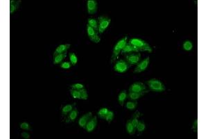 Immunofluorescence staining of HepG2 cells with ABIN7153038 at 1:166, counter-stained with DAPI. (FOXE3 Antikörper  (AA 4-74))