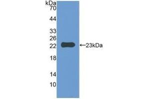 Detection of Recombinant IAP, Mouse using Polyclonal Antibody to Integrin Associated Protein (IAP) (CD47 Antikörper  (AA 18-219))