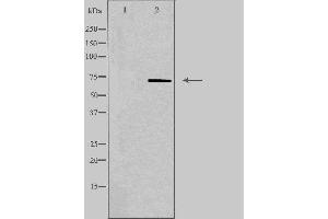 Western blot analysis of extracts from Jurkat cells, using PLA2G4C antibody. (PLA2G4C Antikörper  (Internal Region))