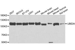 Western blot analysis of extracts of various cell lines, using UBE3A antibody. (ube3a Antikörper  (AA 300-590))