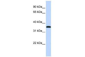 VGLL3 antibody used at 1 ug/ml to detect target protein. (VGLL3 Antikörper)