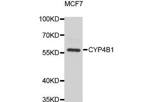 Western blot analysis of extracts of MCF7 cell lines, using CYP4B1 antibody. (CYP4B1 Antikörper)