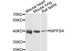 Western blot analysis of extracts of various cell lines, using INPP5A antibody (ABIN5971690) at 1/1000 dilution.