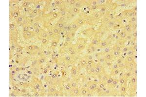Immunohistochemistry of paraffin-embedded human liver tissue using ABIN7143385 at dilution of 1:100