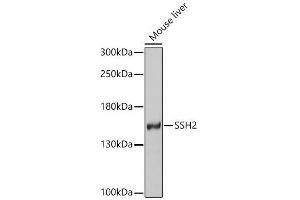 Western blot analysis of extracts of various cell lines, using SSH2 antibody (ABIN4905305) at 1:1000 dilution. (JAM2 Antikörper)