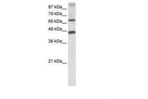 Image no. 1 for anti-Zinc Finger Protein 79 (ZNF79) (AA 107-156) antibody (ABIN202665) (ZNF79 Antikörper  (AA 107-156))