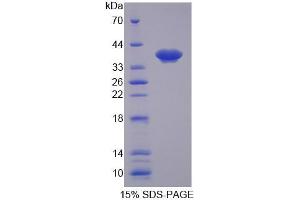 SDS-PAGE analysis of Human SLC25A39 Protein. (SLC25A39 Protein)