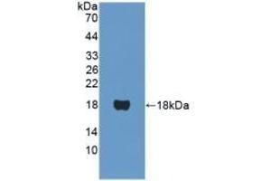 Detection of Recombinant PPARa, Human using Polyclonal Antibody to Peroxisome Proliferator Activated Receptor Alpha (PPARa) (PPARA Antikörper  (AA 61-170))