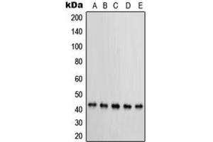 Western blot analysis of PRKAR1B expression in MCF7 (A), KNRK (B), NIH3T3 (C), HeLa (D), BT20 (E) whole cell lysates. (PRKAR1B Antikörper  (Center))