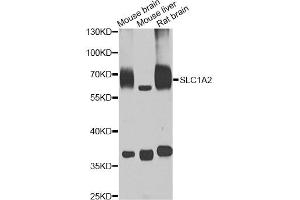 Western blot analysis of extracts of various cell lines, using SLC1A2 antibody (ABIN5995519) at 1/1000 dilution. (SLC1A2 Antikörper)