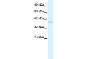WB Suggested Anti-RIMS3 Antibody Titration:  1. (RIMS3 Antikörper  (C-Term))